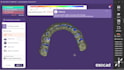 design all on x, all on 4 prosthesis using exocad