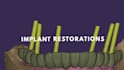 provide professional dental cad design using exocad