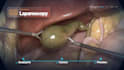 create surgical animation and medical procedure videos