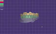 design professional dental cad designs using exocad