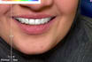 create accurate dental cad designs for labs and clinics
