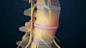 create professional 3d spine surgery orthopedic and medical animation