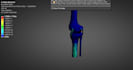 perform stress analysis and biomechanical behavior in ansys