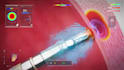 create 3d cardiovascular medical device animation, stent and catheter explainer