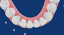 create expert clear aligner treatment plans for orthodontists