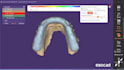 design professional dental cad design for bite splint
