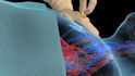 create 3d medical surgery animation and surgical procedure