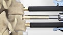 create 3d surgical procedure animation for medical education
