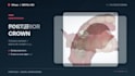 design anterior and posterior dental crowns using 3shape
