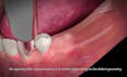 create scientifically accurate 3d medical animation, 3d dental animation