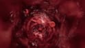 animate a 3d surgical or cardiovascular procedure walkthrough