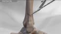 create professional 3d surgical and orthopedic medical animations