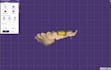 design dental crowns and bridges