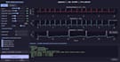 ecg signal processing, arrhythmia detection, and biomedical data analysis