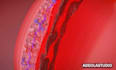 create best 3d medical explainer animation video for 3d sepsis retained placenta