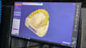 design zirconia bridge and crowns using exocad