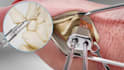 create 3d medical animation, healthcare explainer and scientific animation