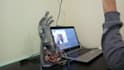 do a prosthetic hand that works using a camera with ai