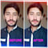 retouch your image with high quality and remove blemish