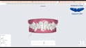 design orthodontic planning for clear aligner treatments