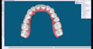 do dental clear aligner treatment planning on onyxceph, hit and 3shape analyzer