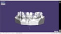 setup exocad 3,2 and partial cad software with guarantee