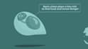 create an animated explainer video