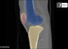 offer medical annotation services for ai model training