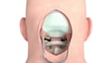 create 3d medical animation video,3d animation, 2d 3d animation video, surgery